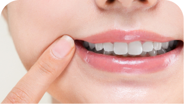 審美歯科（セラミック）